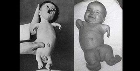閲覧注意 チェルノブイリ原発事故後の奇形児たち 放射能汚染 ざっくりな世界史